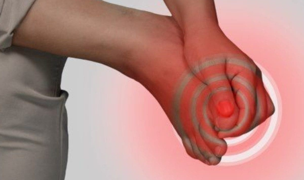 Tudo sobre unhas encravadas: como evitar ou tratar este problema