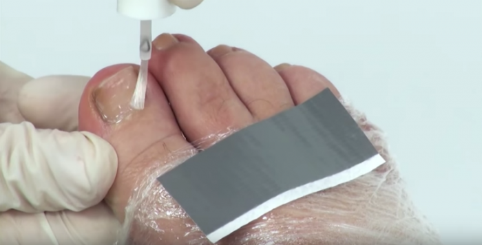 Encharcando as cutículas com PodoSafe 30ml