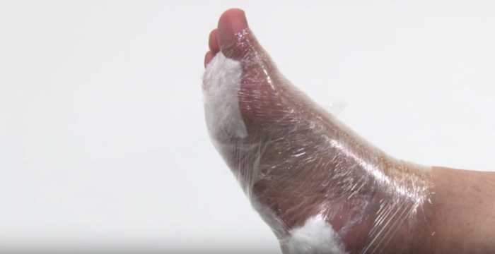 Pé enrolado com plático filme que segura as bandagens com o produto aplicado